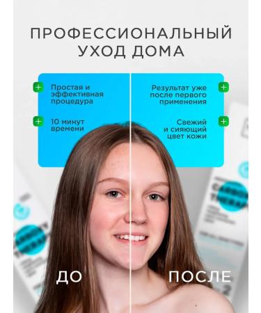 NSC Carboxytherapy for the face and neck set of Korea masks 2 procedures - Buy Online on GoSupps.com