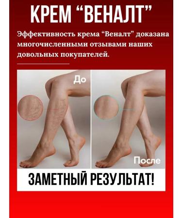 Gold Altai Cream for leg and veins against severity and edema - Buy Online on GoSupps.com