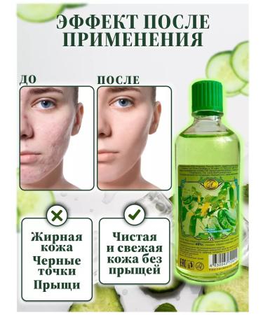 WONDERCOSM Cucumber sip for face and hands remedy for acne rash - Buy Online on GoSupps.com