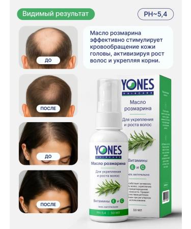 Yones Rosemary oil for hair growth - Buy Online on GoSupps.com