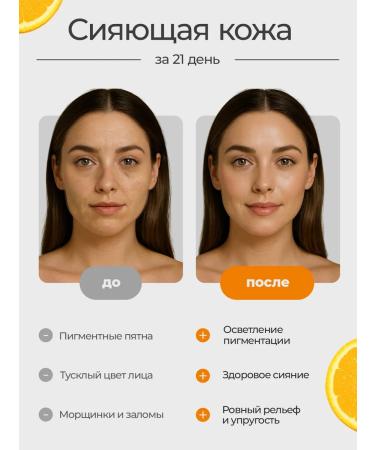 NANO SKIN Facial cream with vitamin C from anti -aging pigmentation - Buy Online on GoSupps.com