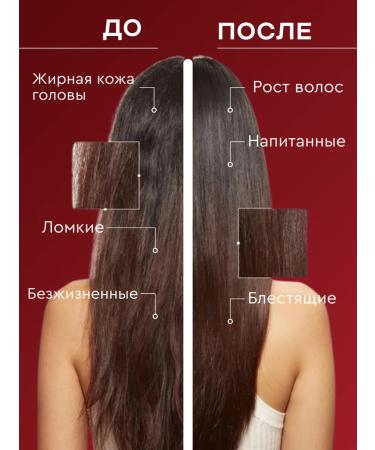 AL SHARAT Set of seborrheal shampoo and balm -Contractor - Buy Online on GoSupps.com