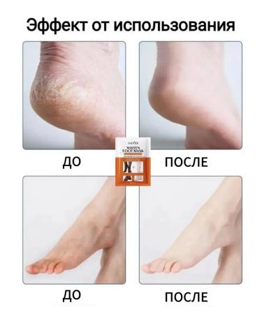 sadoer Whitening foot mask niacinamide and vitamin C socks - Buy Online on GoSupps.com