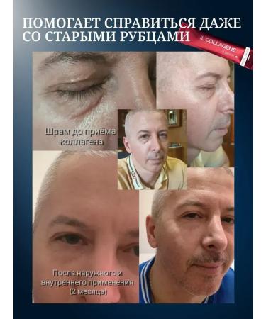 Therapeutic collagen forte - Buy Online on GoSupps.com