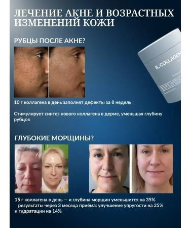 Therapeutic collagen forte - Buy Online on GoSupps.com