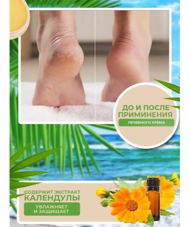 China World Anti-Crack cream wax from cracks - Buy Online on GoSupps.com