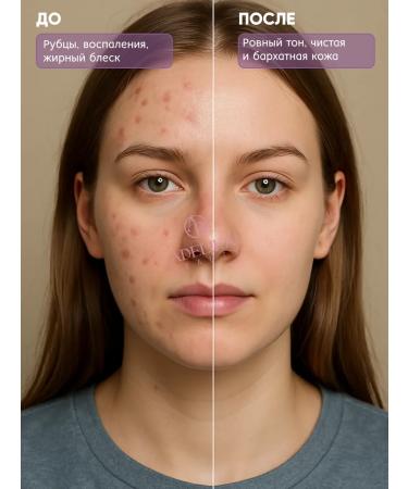 Etude House Korea's face scrub Soda Baking Powder - Buy Online on GoSupps.com