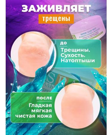 Alganika Feet cream and heels from cracks and corns 500 - Buy Online on GoSupps.com