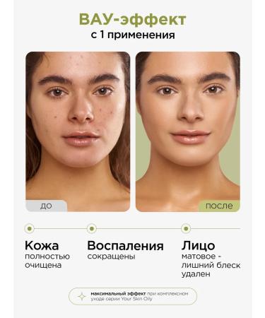 MIXIT Gel for washing the face from acne with niacinamide 150ml - Buy Online on GoSupps.com