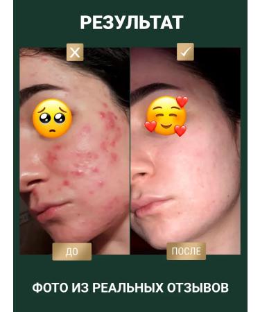 Doctor Face Acne serum for face - Buy Online on GoSupps.com