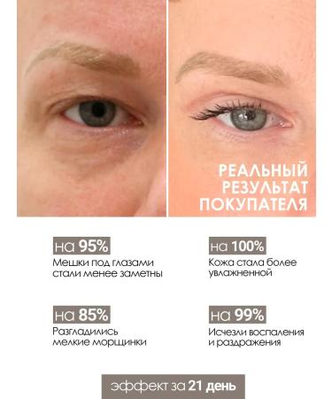 The Virgin Beauty Eye cream from edema - Buy Online on GoSupps.com