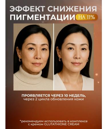 DERMAGARDEN Moisturizing face whitening from age spots - Buy Online on GoSupps.com