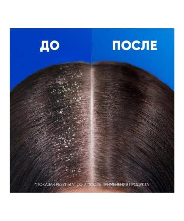 Head & Shoulders Shampoo against dandruff apple freshness 40 - Buy Online on GoSupps.com