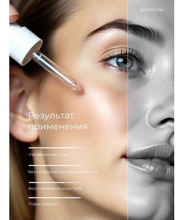 Yar'Co The person s serum narrows the pores and against acne 30 ml - Buy Online on GoSupps.com