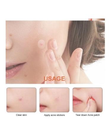 Patching parsing 36 pcs - Buy Online on GoSupps.com