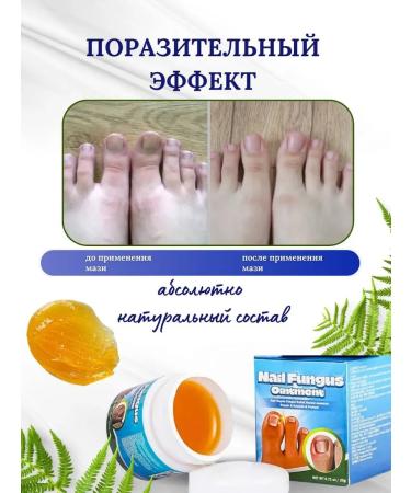 Remedy for nail fungus - 20 g - Buy Online on GoSupps.com