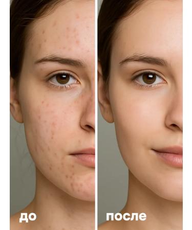 BAZE Face cream with a complex of acids and niacinamide 150 ml - Buy Online on GoSupps.com
