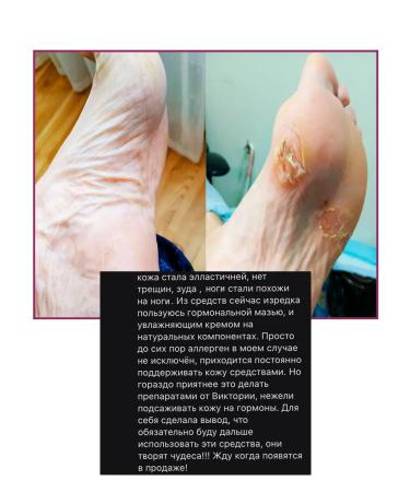 LIVSI Set Lotion for skin cream wax mask from cracks on heels - Buy Online on GoSupps.com