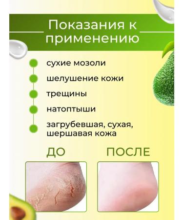 Vitex Feet cream from cracks and dry corner moisturizing - Buy Online on GoSupps.com