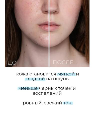 Elizavecca Tonic-peeling with fruit acids - Buy Online on GoSupps.com