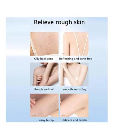 Peels Facial and body sling - Buy Online on GoSupps.com