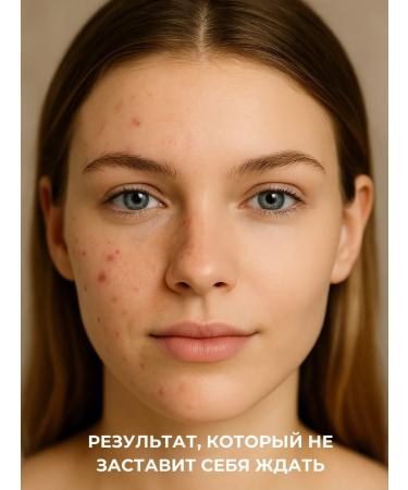 V45 Face cream from acne emulsion for problem skin 500 ml - Buy Online on GoSupps.com