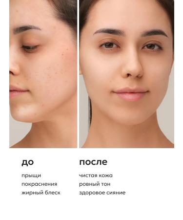 Likato professional Facial spareer serum from acne 50 ml - Buy Online on GoSupps.com