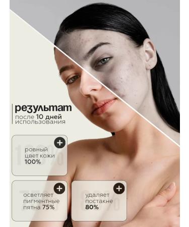 VIS MEDICUS Whitening face cream from pigmentation - Buy Online on GoSupps.com