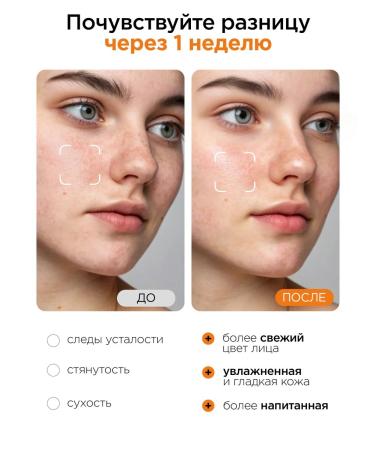 MIXIT Facial tonic foam and cream with vitamin C and LAB cramids - Buy Online on GoSupps.com