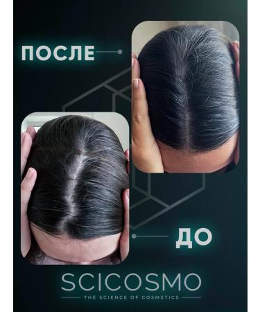SciCosmo A set of 3 balms against loss and hair growth - Buy Online on GoSupps.com