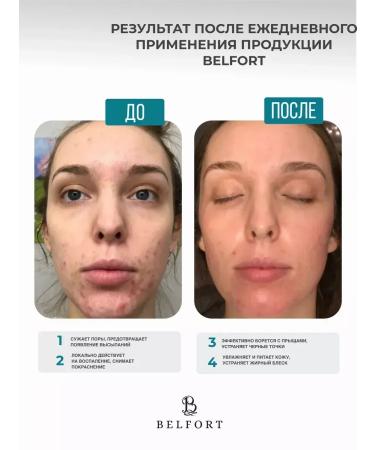 BELFORT Lotion Chatterbox for Facial and Body from acne 100 ml - Buy Online on GoSupps.com