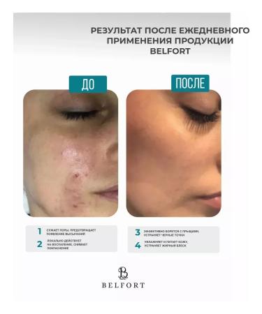 BELFORT Lotion Chatterbox for Facial and Body from acne 100 ml - Buy Online on GoSupps.com