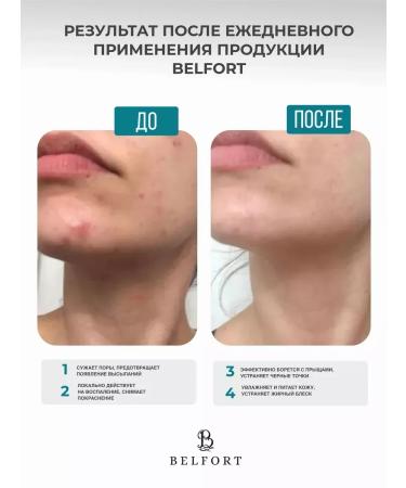 BELFORT Lotion Chatterbox for Facial and Body from acne 100 ml - Buy Online on GoSupps.com