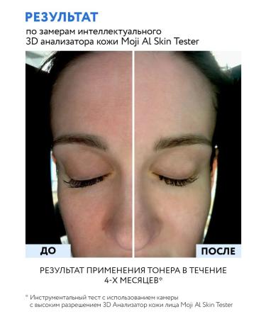 ARAVIA Professional Liposomal Toner for the face Retinol 0.2 150 ml - Buy Online on GoSupps.com