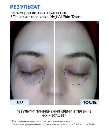 ARAVIA Professional Liposomal skin cream around the eyes with retinol 0.1 - Buy Online on GoSupps.com