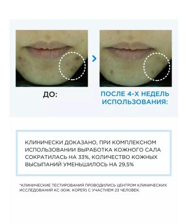 Tony Moly Moisturizing emulsion for the face from acne - Buy Online on GoSupps.com