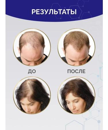 Kirkland Minoxidin 5% for Hair growth and beard Original - Buy Online on GoSupps.com