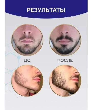 Kirkland Minoxidin 5% for Hair growth and beard Original - Buy Online on GoSupps.com