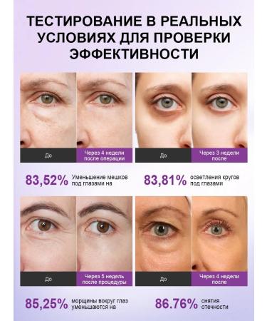 VGO Skin cream around the eyes with the Pro-XLane complex 15 ml - Buy Online on GoSupps.com