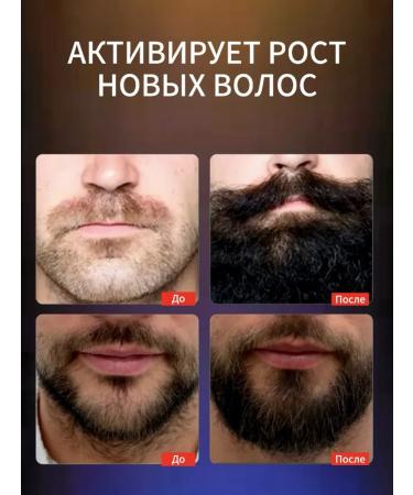 sadoer Serum oil for beard and mustache softening with aroma - Buy Online on GoSupps.com