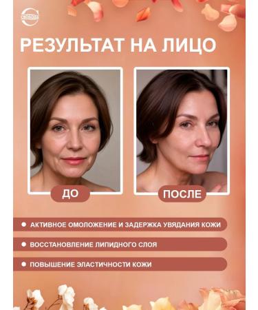 FREEDOM Face cream gerontol nutritional 3pcs - Buy Online on GoSupps.com