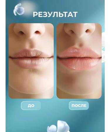 A treasure trove Lip set shine for enlargement and oil - Buy Online on GoSupps.com