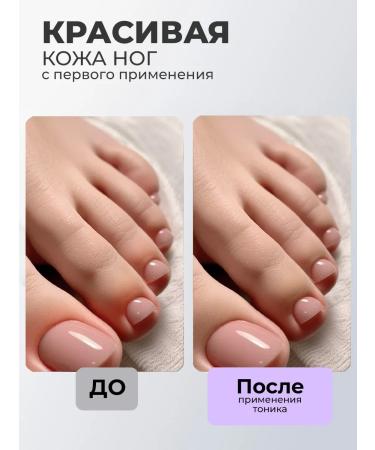 TNL PROFESSIONAL Dehydrating tonic for hands with the effect of Photoshop Marshop - Buy Online on GoSupps.com