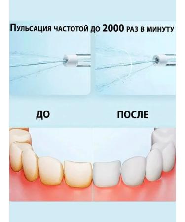 Xiaomi Irrigator for teeth and gums - Buy Online on GoSupps.com