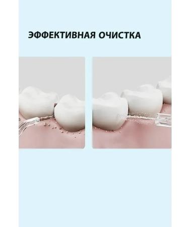 Xiaomi Irrigator for teeth and gums - Buy Online on GoSupps.com