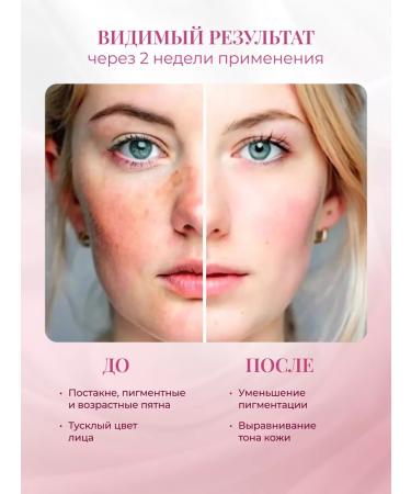 Rose of Bulgaria Face and body cream whitening from pigmentation - Buy Online on GoSupps.com