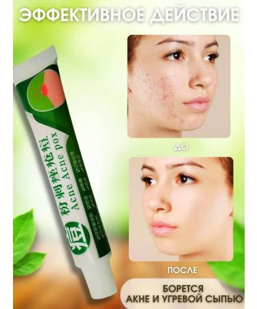 Enough acne cream and acne - Buy Online on GoSupps.com