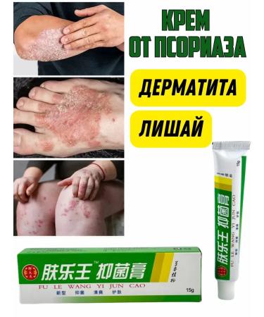 KazPlutos Chinese miracle ointment from psoriasis dermatitis