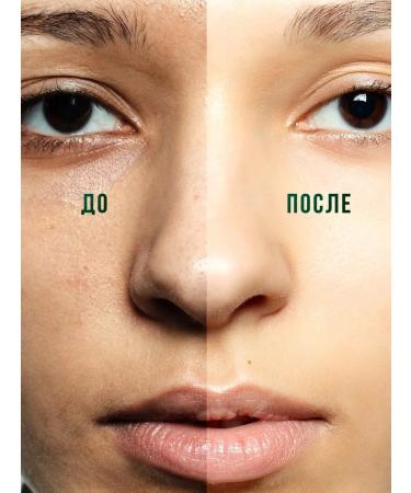 Mesomatrix Professional Facial tonic cleansing 250 ml - Buy Online on GoSupps.com