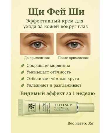 KE The cream around the eyes from edema and bags of wrinkles of anti -aging